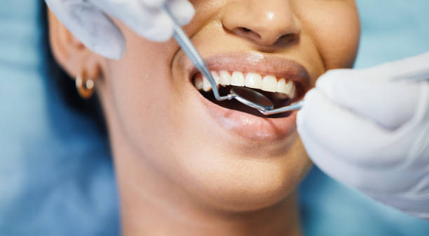 Best Emergency Dental Extractions in Reading, OH